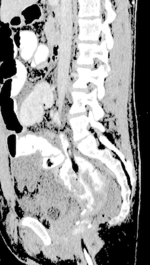 CT Scan - Case Study