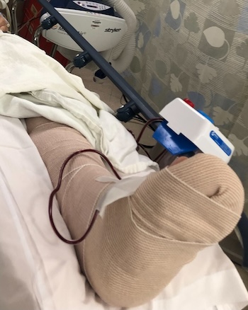 Patient receiving hospital care for a serious leg injury.